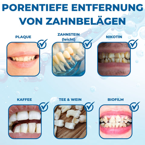 PandaCleaner Dental Konzentrat Ultraschallreiniger - Entfernung von Belägen & Verfärbungen - Für Gebisse, Prothesen, Zahnersatz - Div. Größen